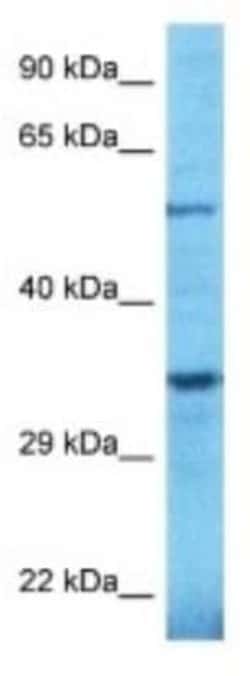 TULP2 Rabbit anti-Human, Polyclonal, Novus Biologicals 100 &mu;g; Unconjugated:Antibodies,
